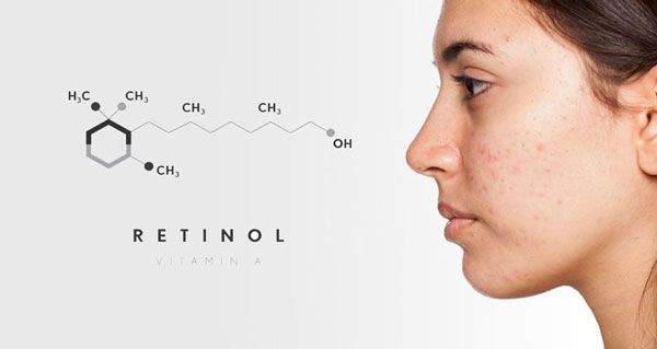Hình ảnh đẩy mụn khi dùng Retinol