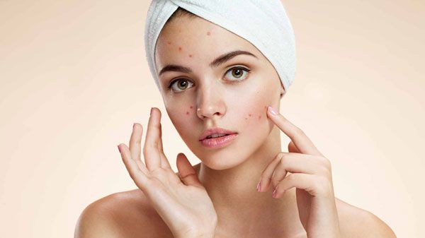 Retinol có tác dụng gì trong quá trình điều trị mụn