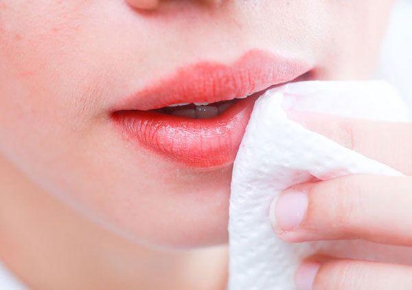 Cách xử lý khi môi sung ngứa