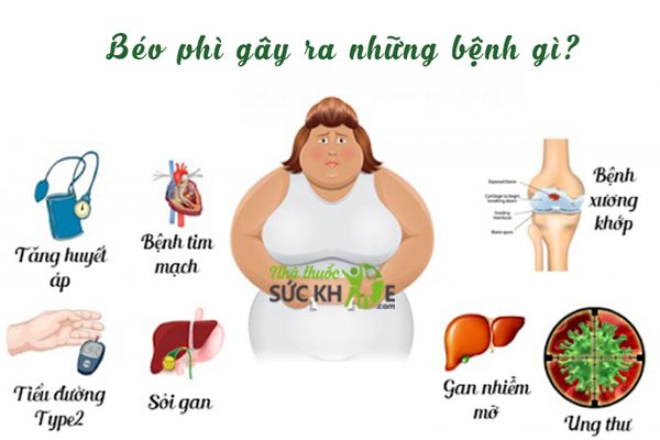 Thừa cân, béo phì gây ra hàng loạt bệnh nguy hiểm