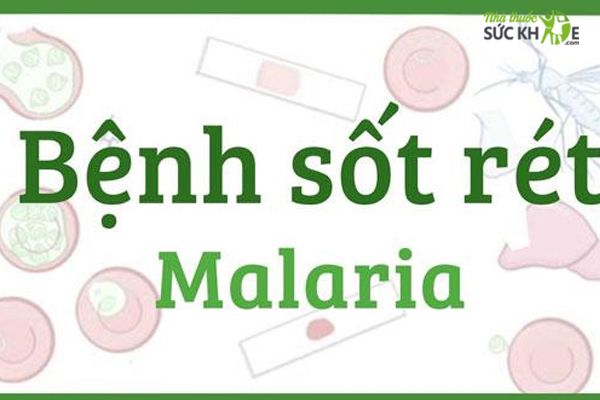 Malaria là gì? Lây truyền như thế nào? Triệu chứng và cách phòng ngừa?