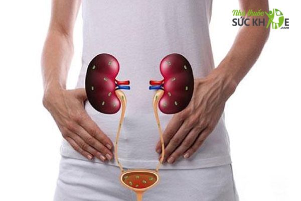 Thuốc Cloxit được chỉ định viêm đường tiết niệu, viêm ruột, viêm não