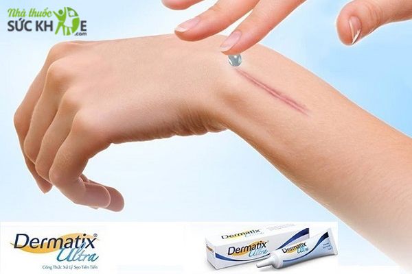 Sử dụng gel Dermatix Ultra bao lâu để hiệu quả