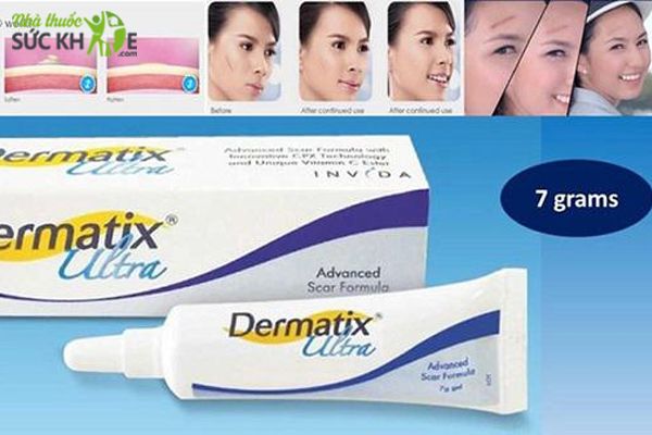 Tác dụng của Dermatix Ultra