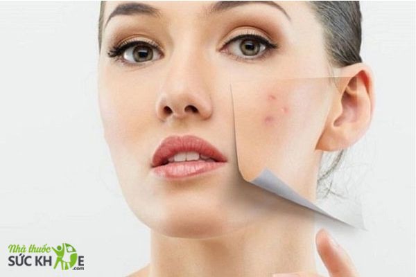 Cải thiện mụn và phục hồi da
