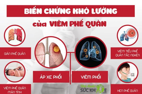 Biến chứng do viêm phế quản