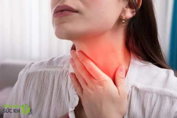 Đau rát cổ họng