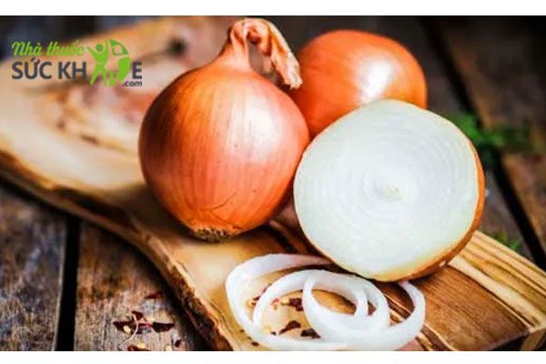 Cách giảm đau rát khi bị bỏng bằng hành tây