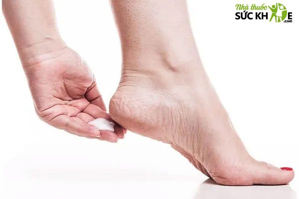 Kem trị nứt gót chân chứa thành phần tái tạo da