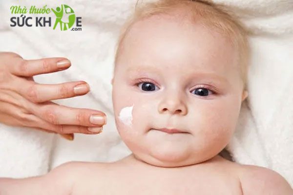 Kem trị chàm sữa cho bé loại nào tốt nhất đang được nhiều phụ huynh quan tâm