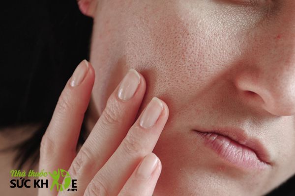 Tùy thuộc vào vấn đề của da để lựa chọn kem dưỡng ẩm phục hồi da