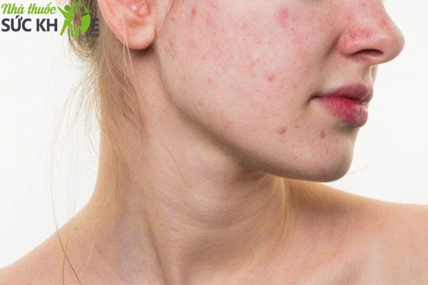 Cách chọn kem dưỡng Eucerin phù hợp với làn da