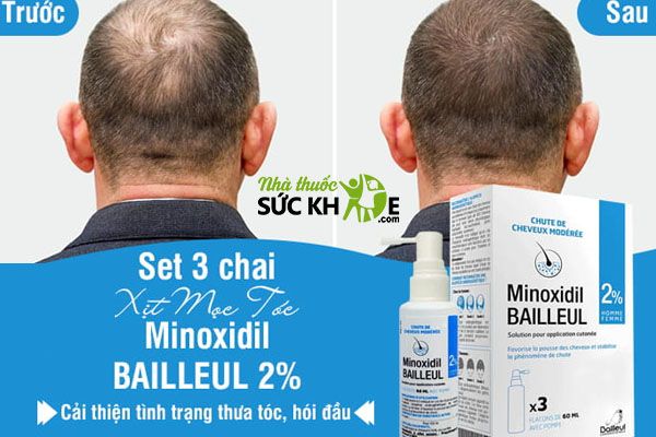 Thuốc xịt mọc tóc cho nam Minoxidil 2%