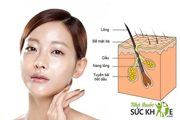 Da dầu mụn lỗ chân lông to gây mất thẩm mỹ, khiến da dễ nổi mụn