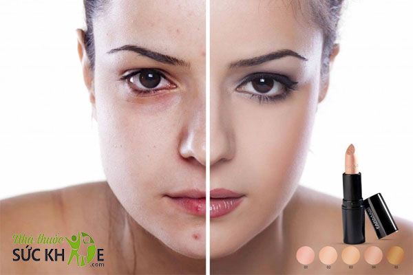 Lựa chọn kem che khuyết điểm phù hợp