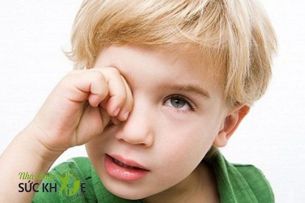 Trẻ bị kh&ocirc;, mỏi mắt khi thiếu Vitamin A
