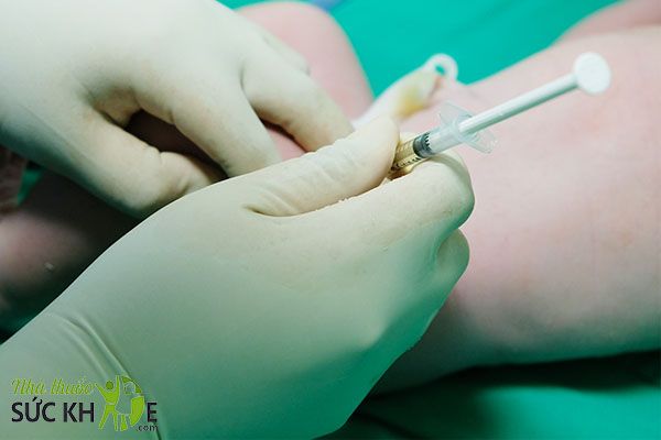 Tiêm Vitamin K cho trẻ sơ sinh ngay khi chào đời