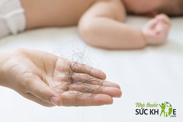 Tóc rụng sau sinh chủ yếu do thay đổi nội tiết trong cơ thể