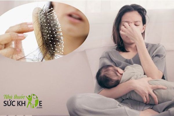 Rụng tóc sau sinh sẽ cải thiện trong 6 tháng- 1 năm