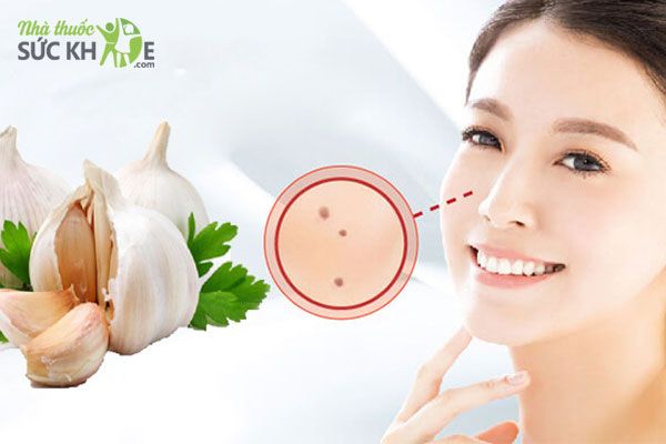 TẨY NỐT RUỒI BẰNG CHANH TƯƠI THEO CÁCH DÂN GIAN ĐƠN GIẢN