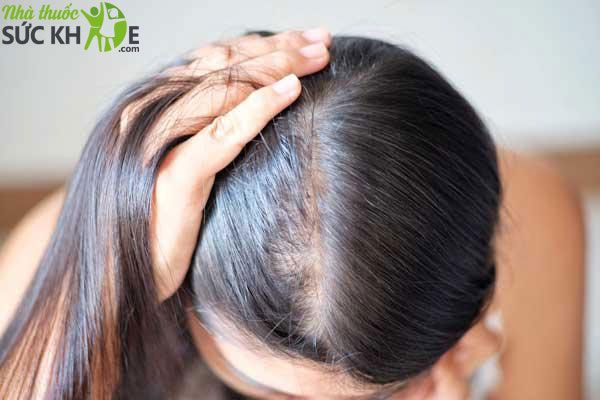 Hướng dẫn cách chọn dầu gội nam phù hợp với từng loại tóc  Chăm sóc cá  nhân  Thuvienmuasamcom