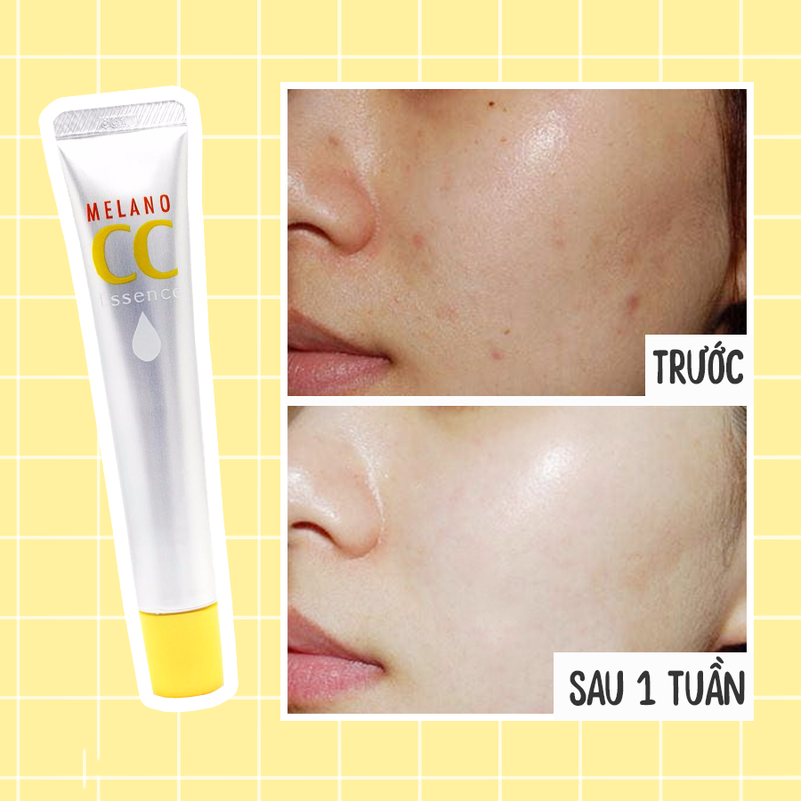 Kh&aacute;ch h&agrave;ng đ&aacute;nh gi&aacute; g&igrave; về Serum CC Melano?