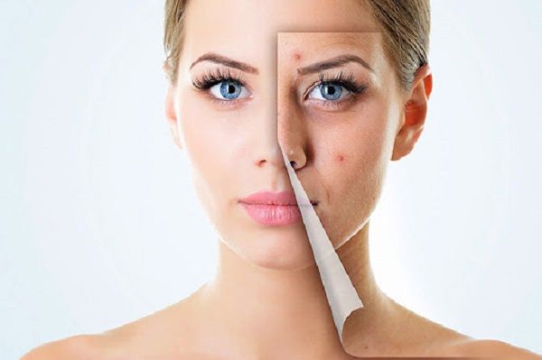 L&agrave;m sạch v&ugrave;ng da bị sẹo trước khi d&ugrave;ng thuốc trị sẹo