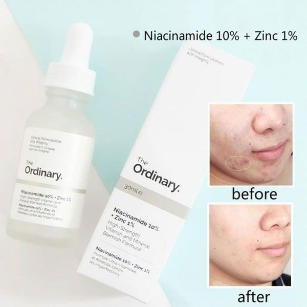 Serum The Ordinary Niacinamide 10% + Zinc 1%