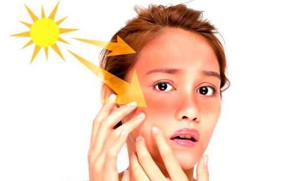 T&aacute;c động từ &aacute;nh nắng v&agrave; m&ocirc;i trường