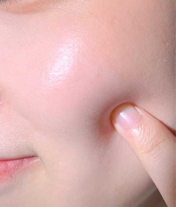 Duy tr&igrave; độ ẩm, dưỡng ẩm cho da