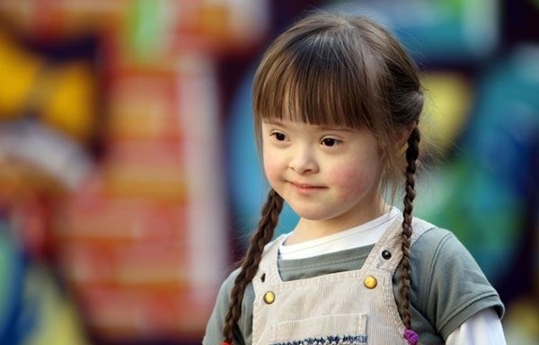 Bệnh Down c&oacute; chữa được kh&ocirc;ng?