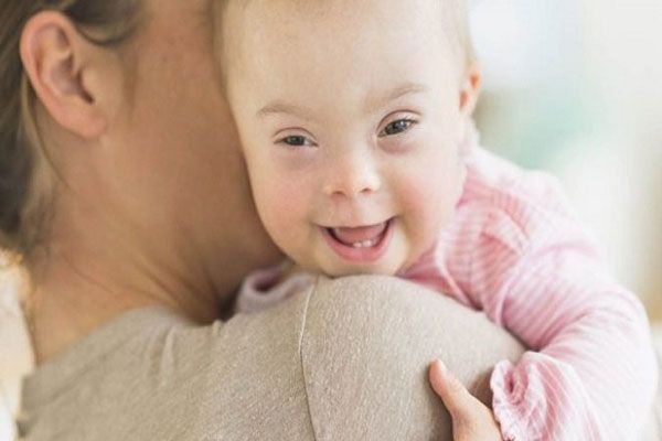 Bệnh Down c&oacute; di truyền kh&ocirc;ng?