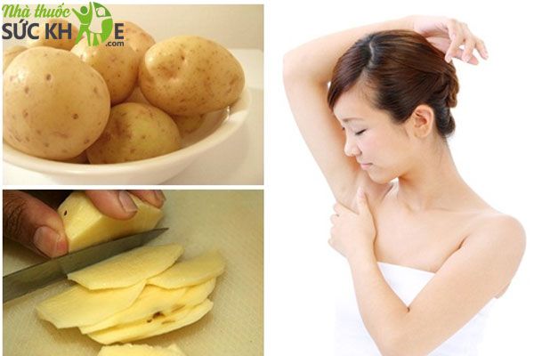 Trị th&acirc;m n&aacute;ch cho mẹ sau sinh bằng khoai t&acirc;y