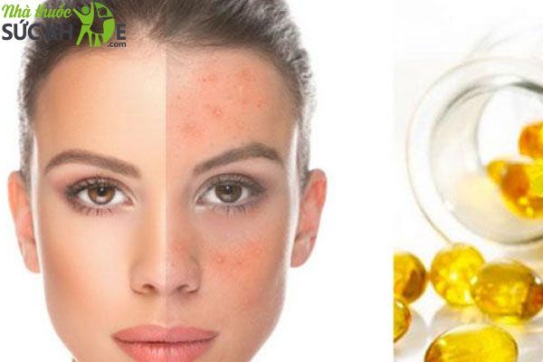 Ch&uacute; &yacute; l&agrave;m sạch da mặt trước khi thoa tinh dầu anh thảo l&ecirc;n da&nbsp;