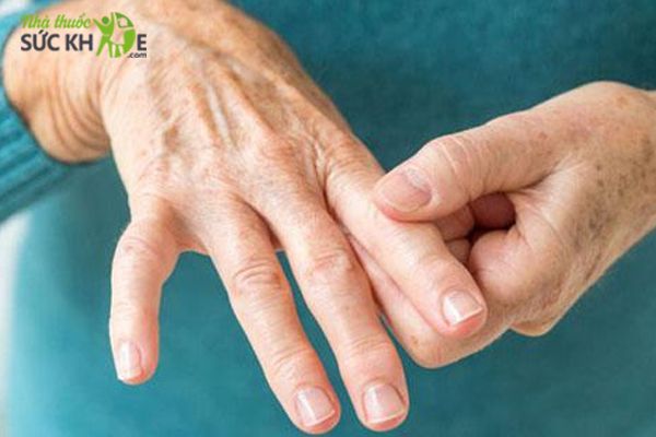 Điều trị bệnh thấp khớp