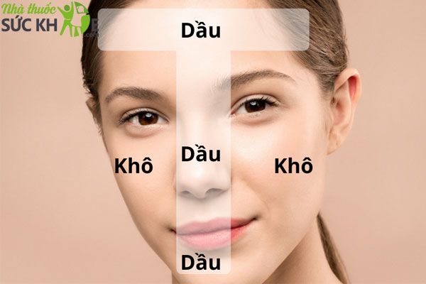Da hỗn hợp thi&ecirc;n dầu thường c&oacute; xu hướng đổ nhiều dầu ở v&ugrave;ng da chữ T