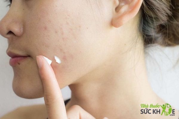 Th&agrave;nh phần Collagen c&oacute; trong kem trị sẹo gi&uacute;p tại tạo tế b&agrave;o da