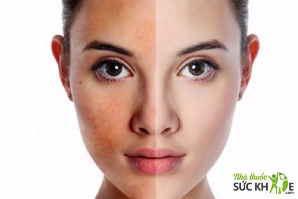 Hạn chế t&igrave;nh trạng da xỉn v&agrave; kh&ocirc;ng đều m&agrave;u