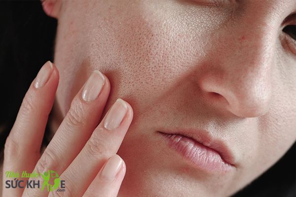 Hỗ trợ l&agrave; se kh&iacute;t lỗ ch&acirc;n l&ocirc;ng
