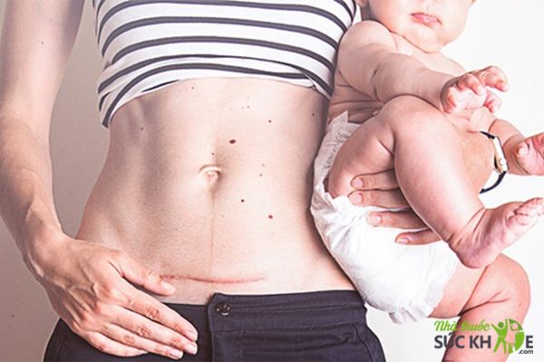 Th&uacute;c đẩy vết thương mau l&agrave;nh