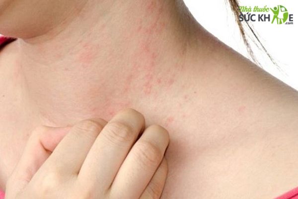 Ngưng sử dụng khi xuất hiện phản ứng lạ
