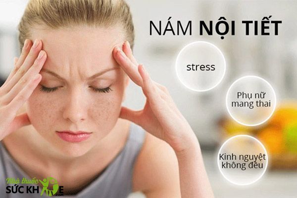 C&aacute;ch sử dụng kem Th&aacute;i trị n&aacute;m