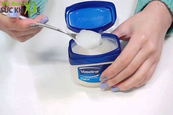C&aacute;ch l&agrave;m giảm đau r&aacute;t khi bị bỏng bằng vaseline&nbsp;