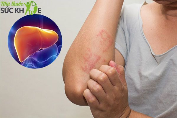 Khi n&agrave;o cần uống thuốc bổ gan của Mỹ