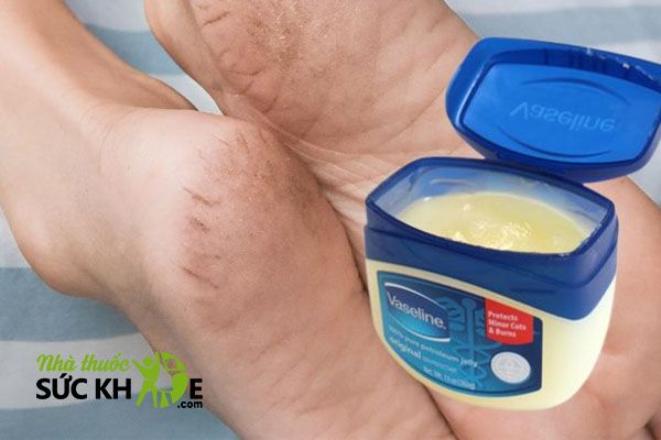Kem trị g&oacute;t ch&acirc;n Vaseline