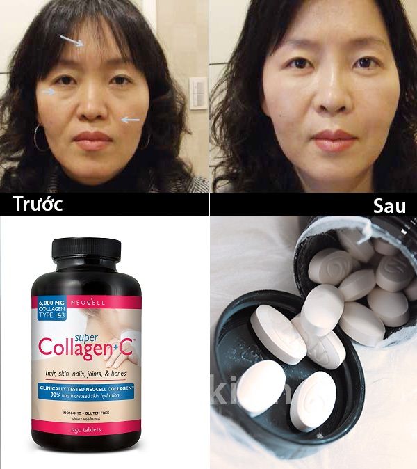 Hiệu quả sau khi sử dụng Super Collagen c 250 viên