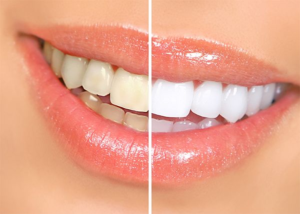 Crest 3D White cung cấp năng lượng giúp làm trắng răng gấp 5 lần so với các sản phẩm thông thường