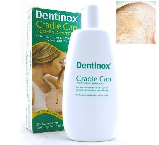 Dầu gội Dentinox giúp loại bỏ hết vảy cứt trâu một cách tự nhiên mà không gây ảnh hưởng đến làn da mỏng manh của bé
