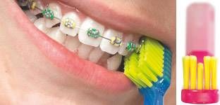 Bàn chải đánh răng Curaprox thiết kế riêng biệt, có một đường rãnh duy nhất ở giữa để phù hợp với dụng cụ niềng răng