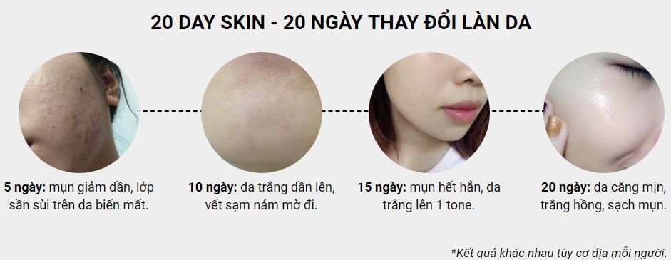 Công dụng của 20 Day Skin